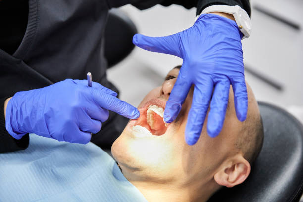 Tooth Infection Emergency Dentist in SC